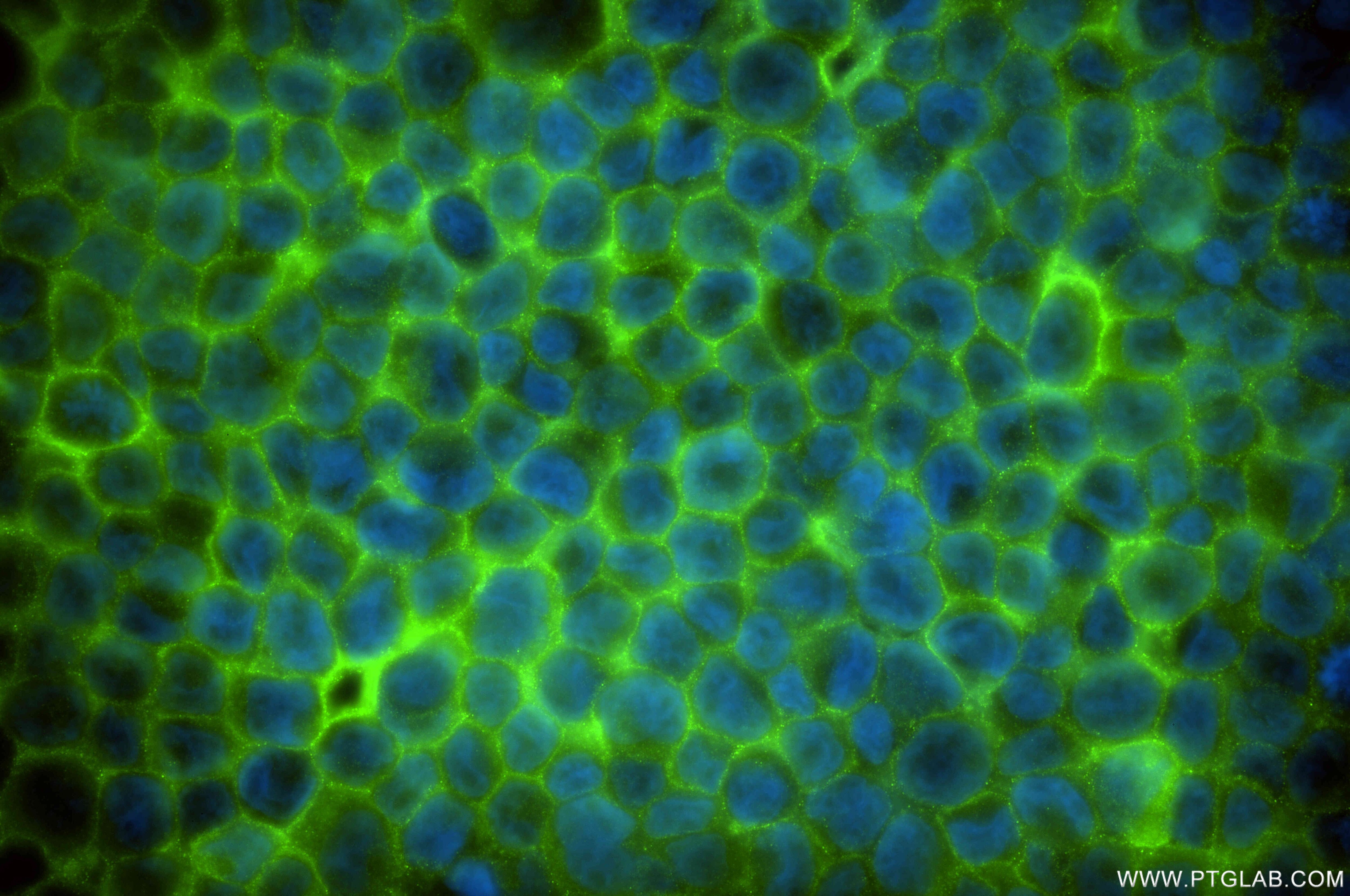 Immunofluorescence (IF) / fluorescent staining of THP-1 cells using CCR2a-specific Recombinant antibody (84911-3-RR)