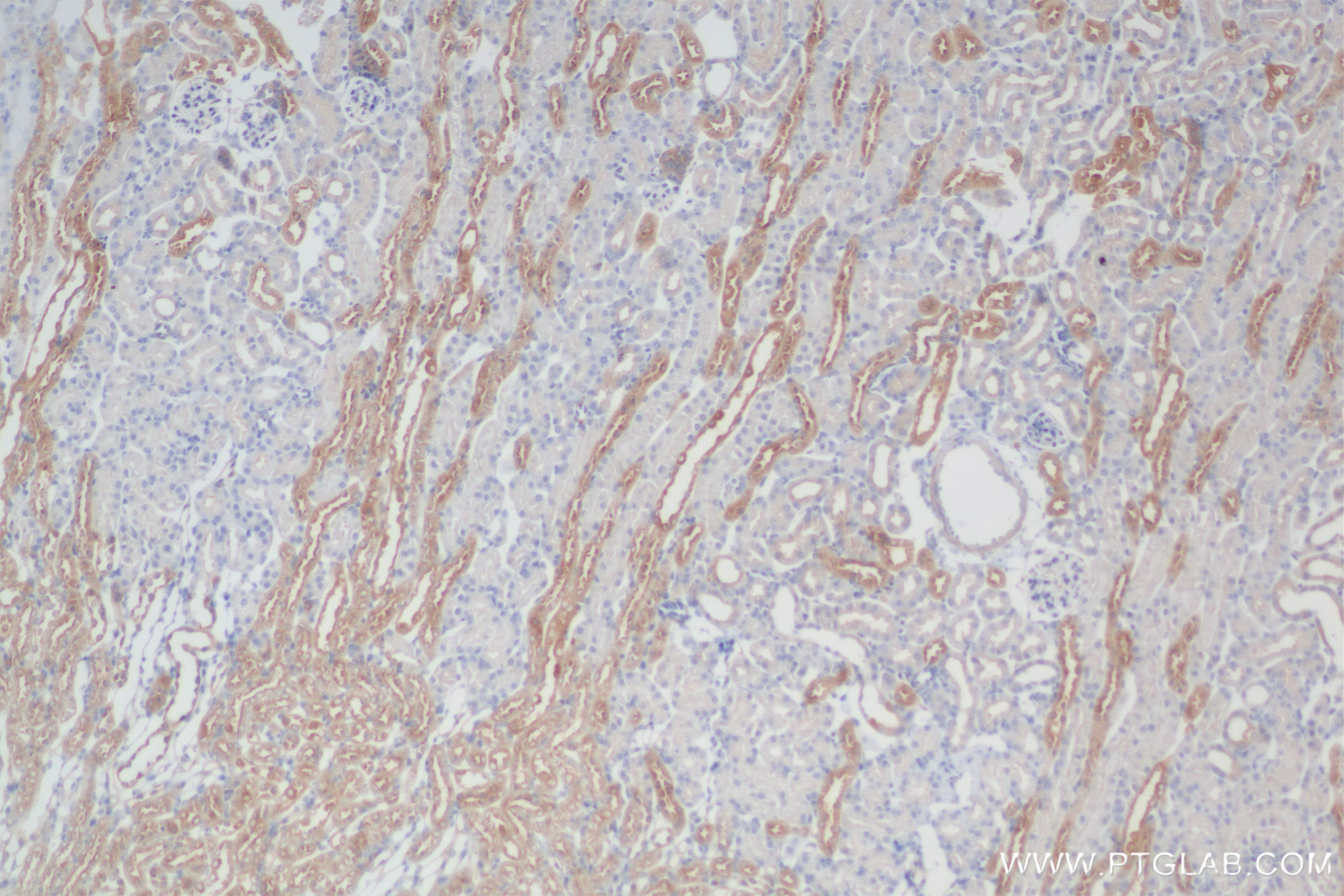 Immunohistochemical analysis of paraffin-embedded mouse kidney tissue slide using 84911-3-RR (CCR2a-specific antibody) at dilution of 1:20000 (under 10x lens). Heat mediated antigen retrieval with Tris-EDTA buffer (pH 9.0). Immunohistochemistry (IHC) staining of mouse kidney tissue using CCR2a-specific Recombinant monoclonal antibody (84911-3-RR)
