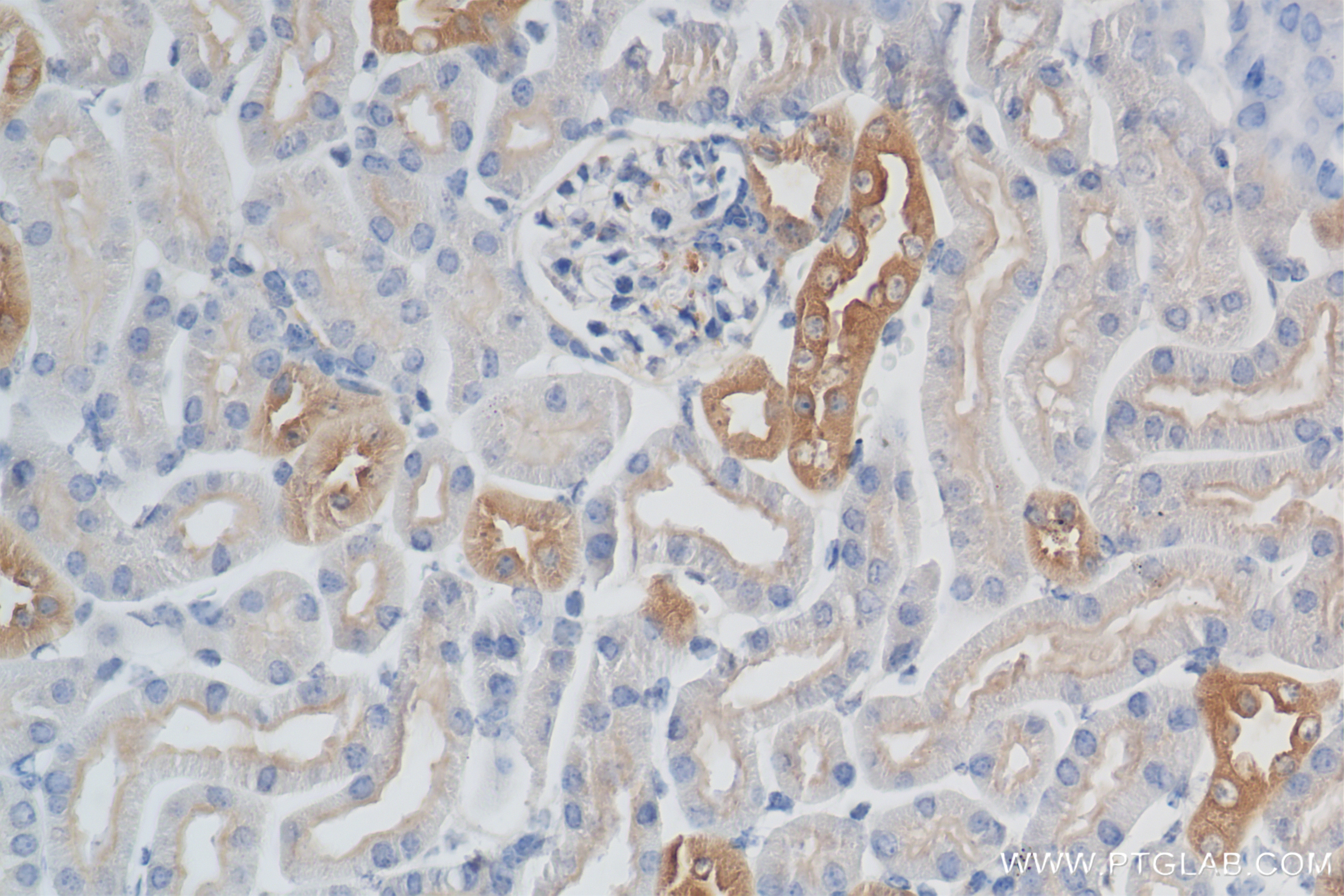 Immunohistochemical analysis of paraffin-embedded mouse kidney tissue slide using 84911-3-RR (CCR2a-specific antibody) at dilution of 1:20000 (under 40x lens). Heat mediated antigen retrieval with Tris-EDTA buffer (pH 9.0). Immunohistochemistry (IHC) staining of mouse kidney tissue using CCR2a-specific Recombinant monoclonal antibody (84911-3-RR)