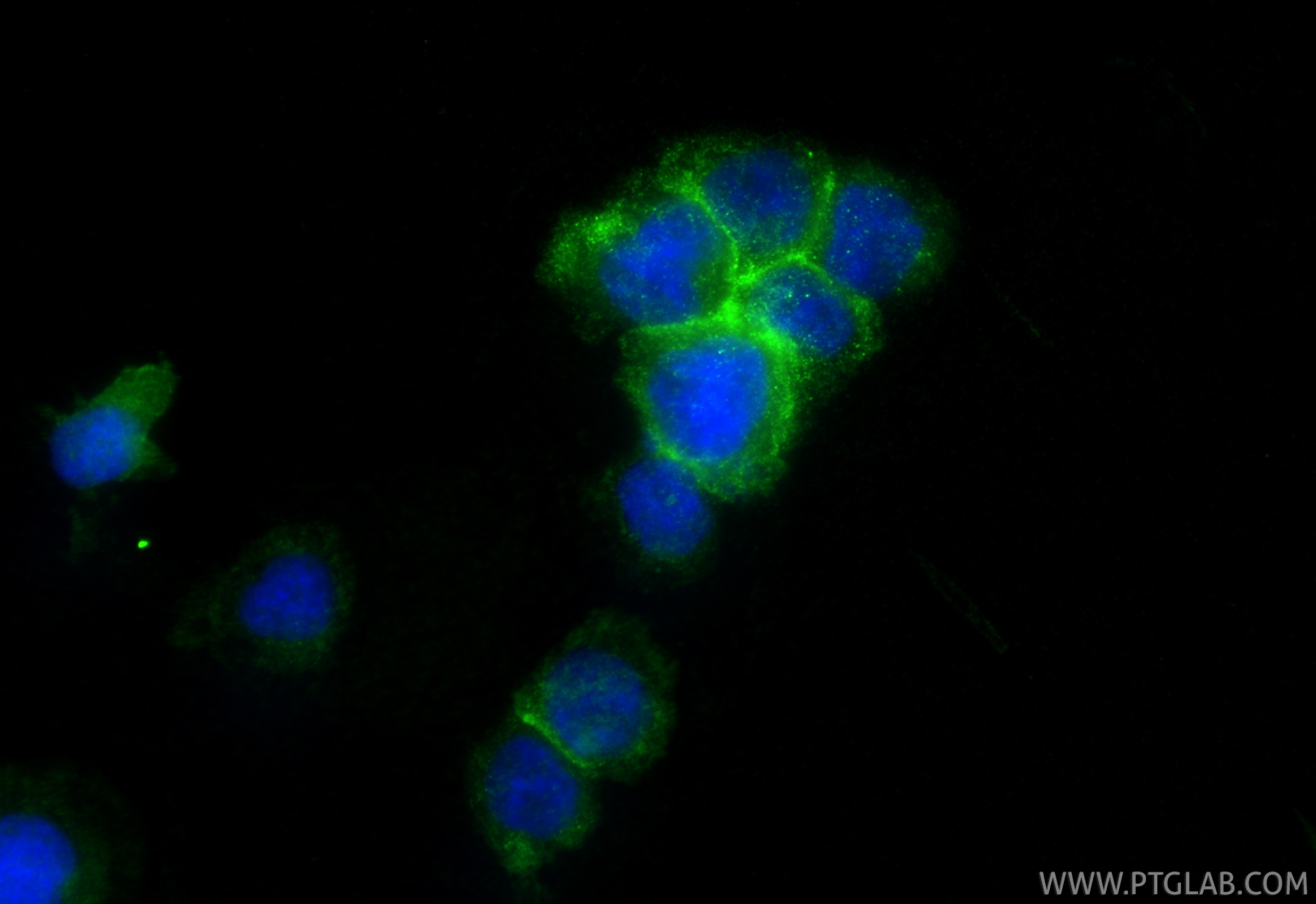 IF Staining of THP-1 using RMX00052 Immunofluorescence (IF) / fluorescent staining of THP-1 cells using Multi-rAb® CCR2a-specific Multi-Recombinant antibo (RMX00052)