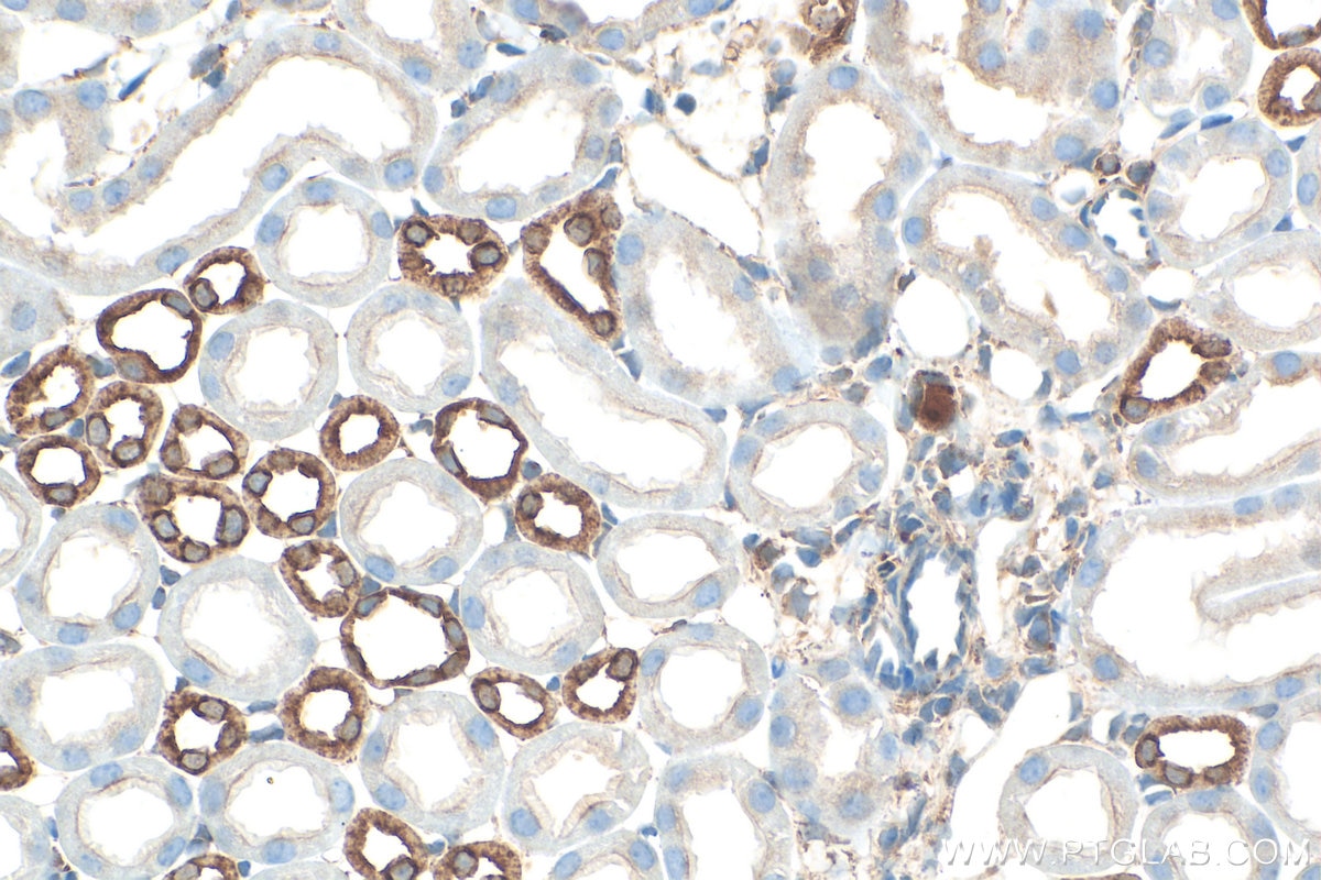 IHC staining of mouse kidney using RMX00052 Immunohistochemistry (IHC) staining of mouse kidney tissue using Multi-rAb® CCR2a-specific Multi-Recombinant antibo (RMX00052)