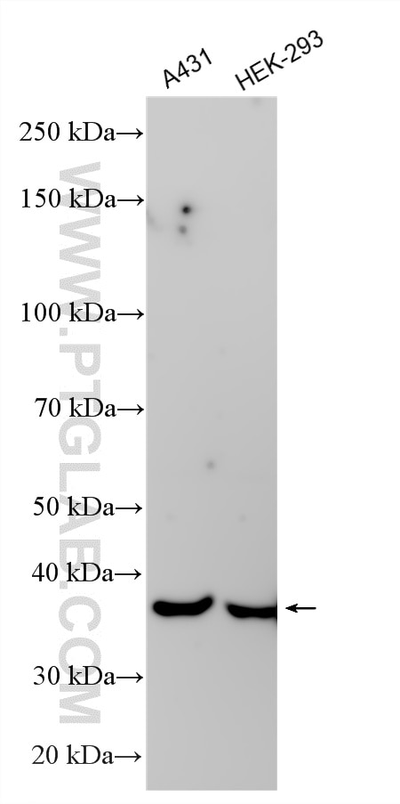 WB analysis using RMX00052 Western Blot (WB) analysis of various lysates using Multi-rAb® CCR2a-specific Multi-Recombinant antibo (RMX00052)