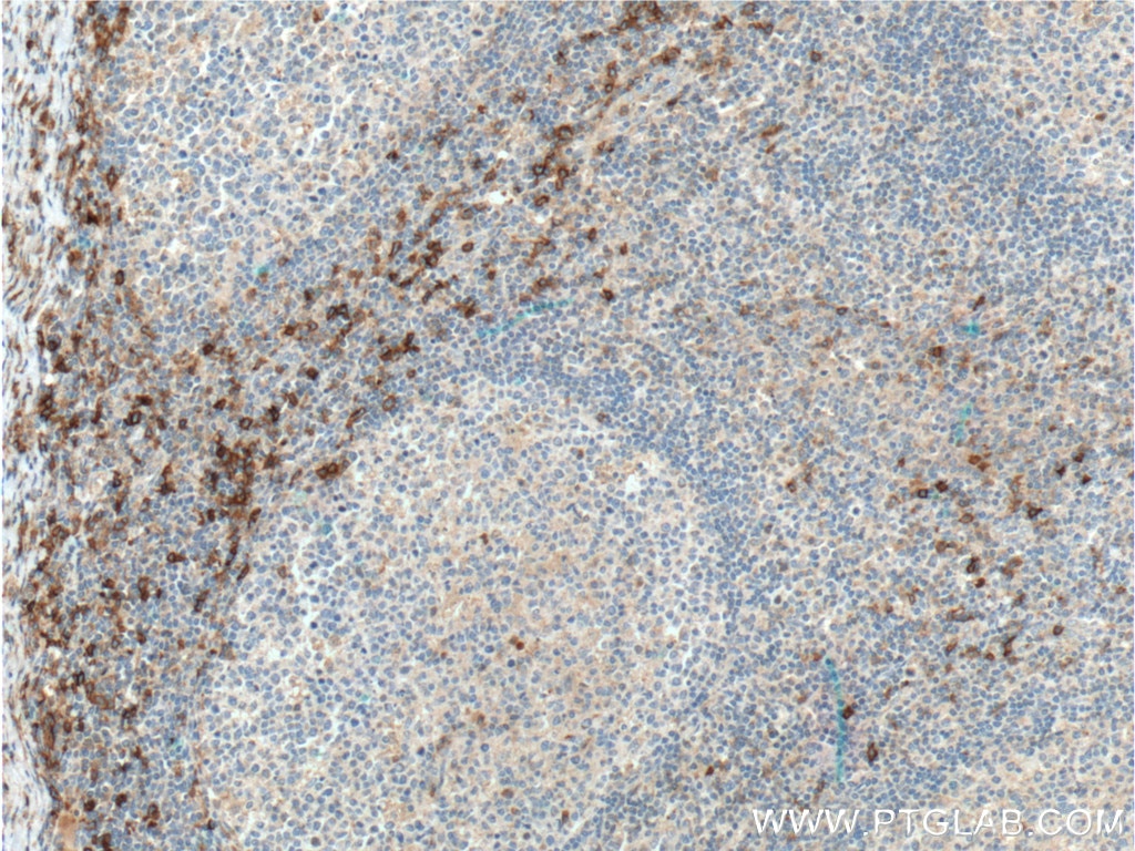 Immunohistochemistry (IHC) staining of human tonsillitis tissue using CCR2b-specific Polyclonal antibody (16154-1-AP)