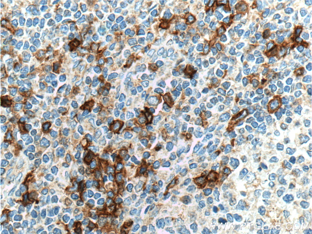 Immunohistochemistry (IHC) staining of human tonsillitis tissue using CCR2b-specific Polyclonal antibody (16154-1-AP)