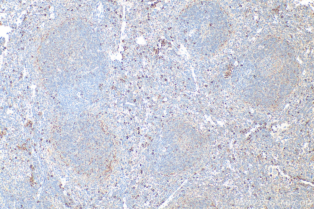 Immunohistochemistry (IHC) staining of mouse spleen tissue using CCR2b-specific Polyclonal antibody (16154-1-AP)