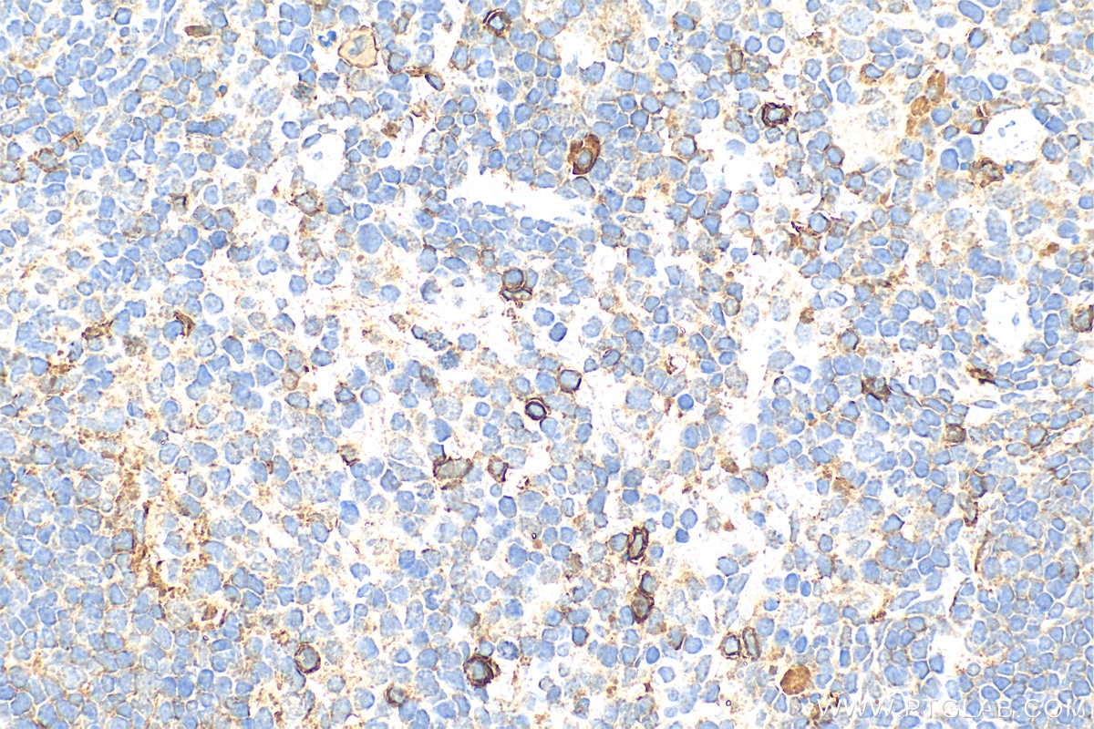 Immunohistochemistry (IHC) staining of mouse spleen tissue using CCR2b-specific Polyclonal antibody (16154-1-AP)