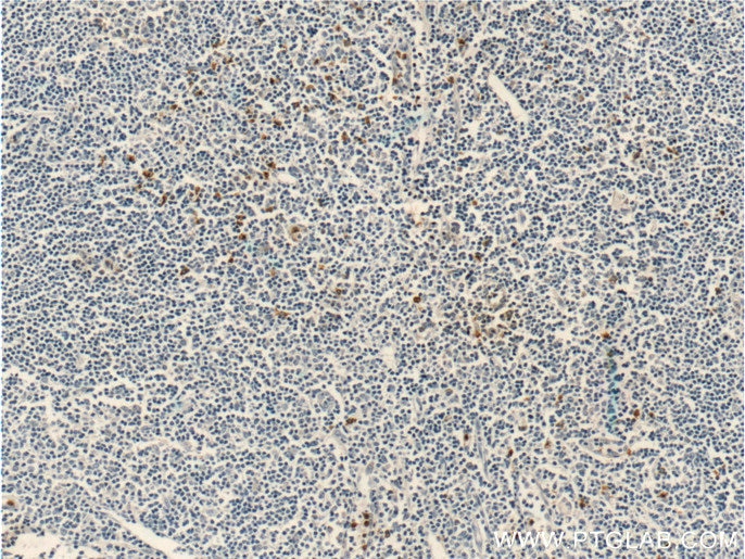 Immunohistochemistry (IHC) staining of human tonsillitis tissue using CCR3 Polyclonal antibody (22351-1-AP)