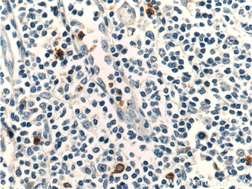 Immunohistochemistry (IHC) staining of human tonsillitis tissue using CCR3 Polyclonal antibody (22351-1-AP)