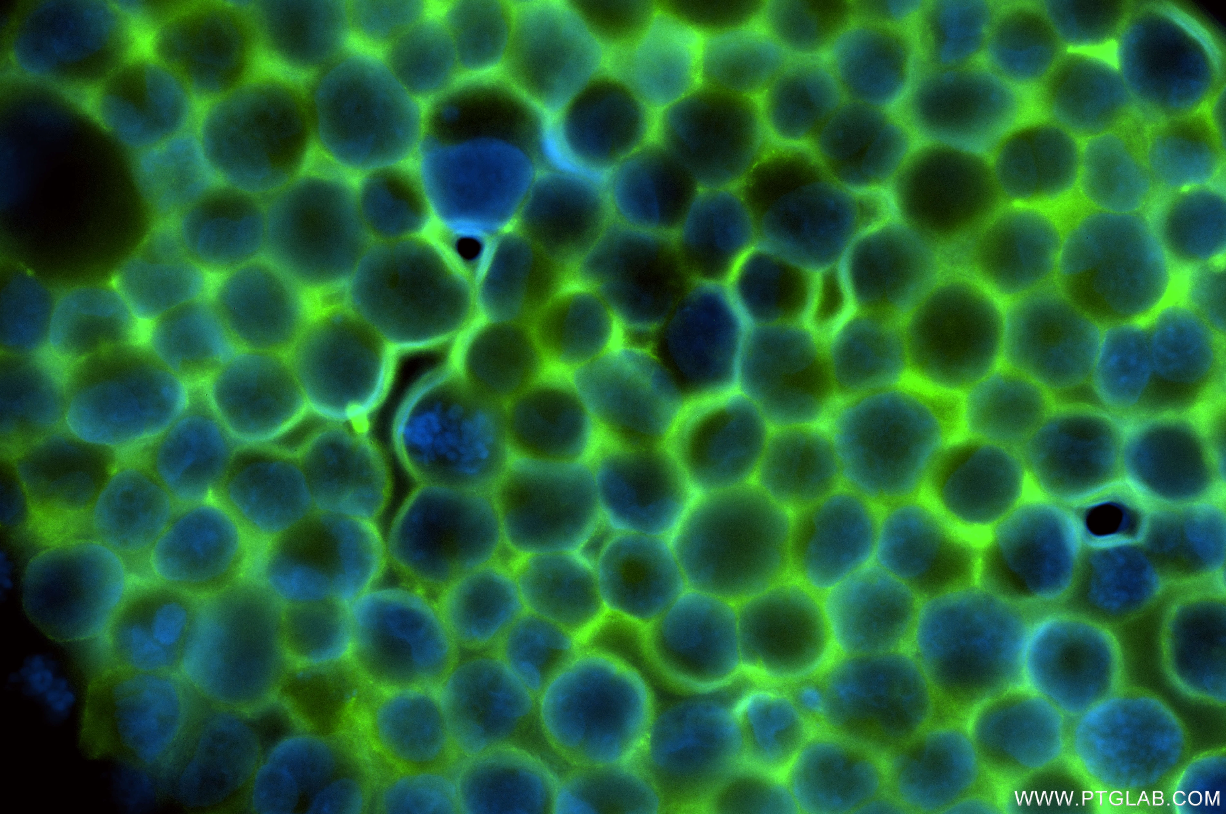 Immunofluorescence (IF) / fluorescent staining of K-562 cells using CCR3 Recombinant antibody (86038-1-RR)