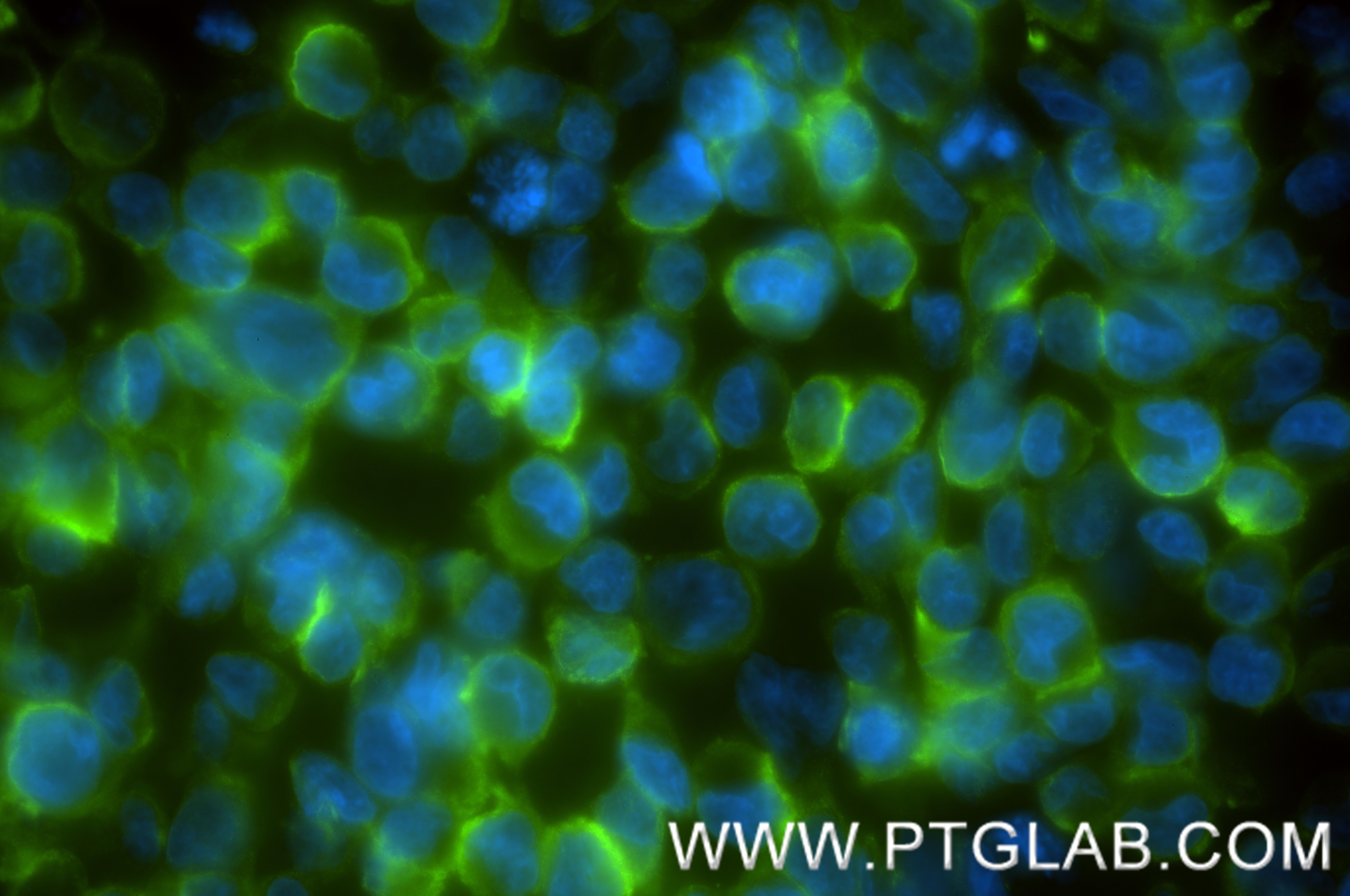 Immunofluorescence (IF) / fluorescent staining of K-562 cells using CCR3 Recombinant antibody (86038-1-RR)
