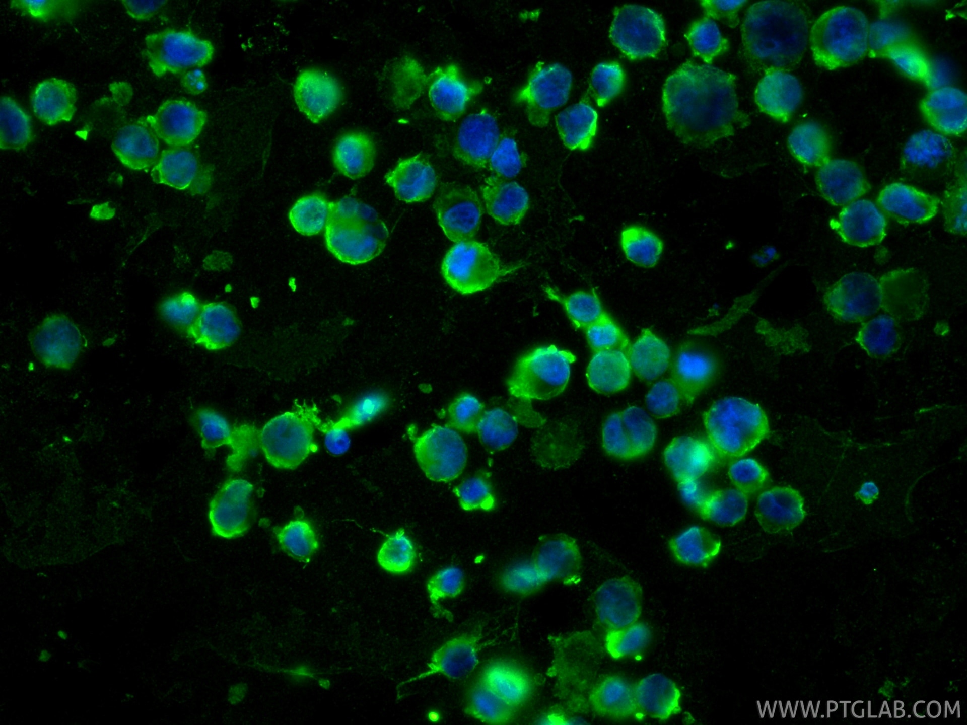 Immunofluorescence (IF) / fluorescent staining of K-562 cells using CCR3 Recombinant monoclonal antibody (86038-1-RR)