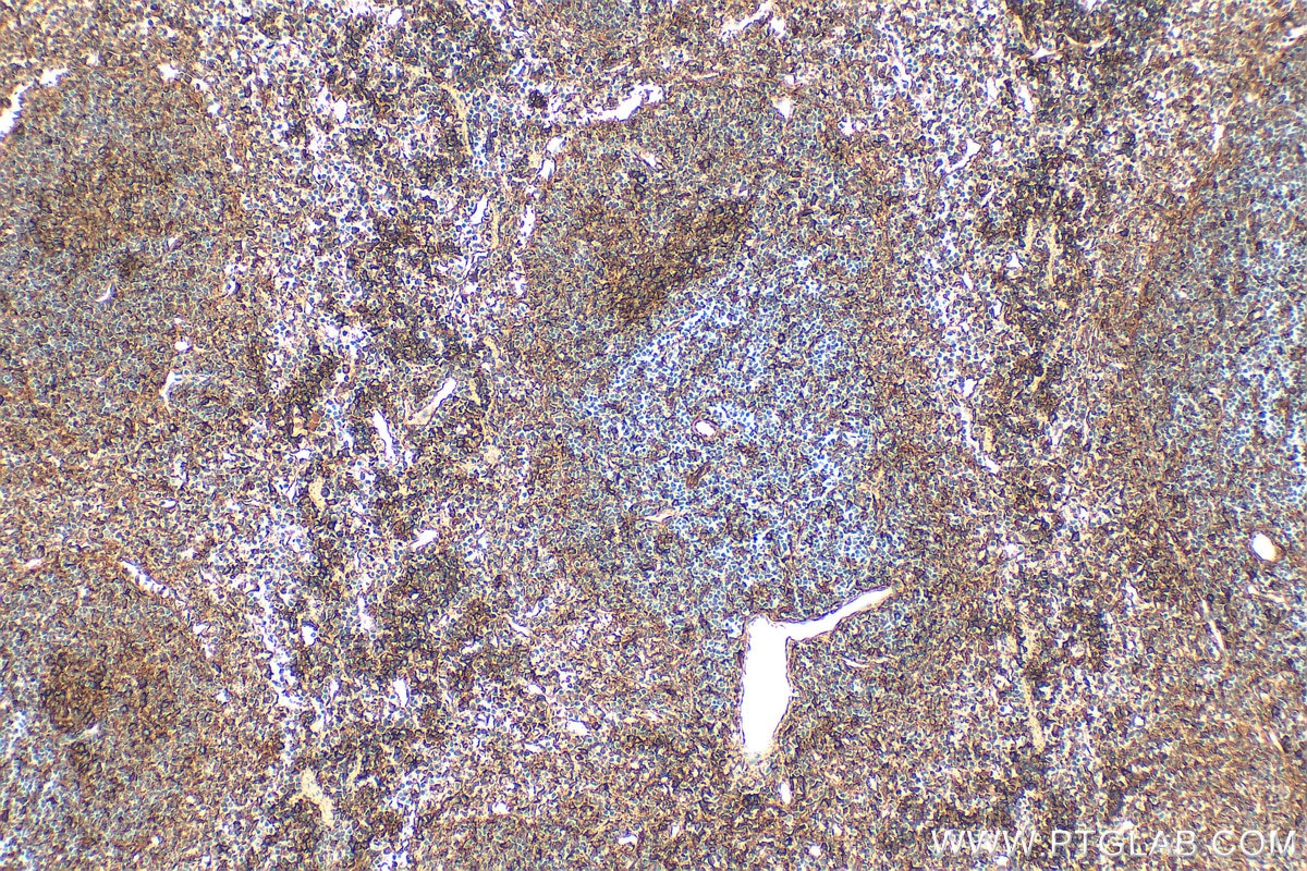 Immunohistochemistry (IHC) staining of mouse spleen tissue using CCR3 Recombinant monoclonal antibody (86038-1-RR)