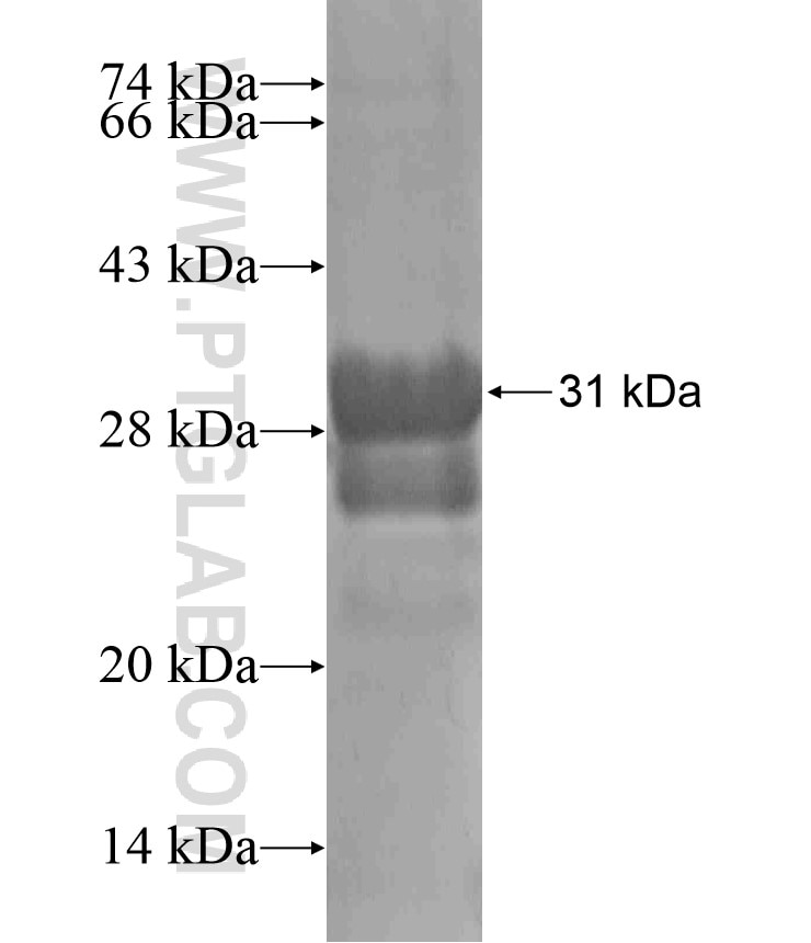 CCR3 fusion protein Ag17926 SDS-PAGE