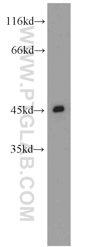CCR5 Polyclonal antibody