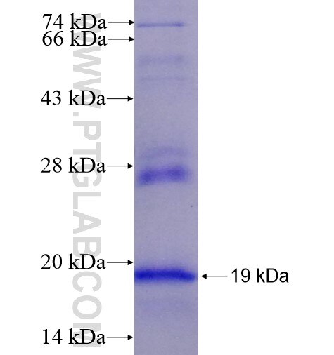 CCR5 fusion protein Ag14631 SDS-PAGE
