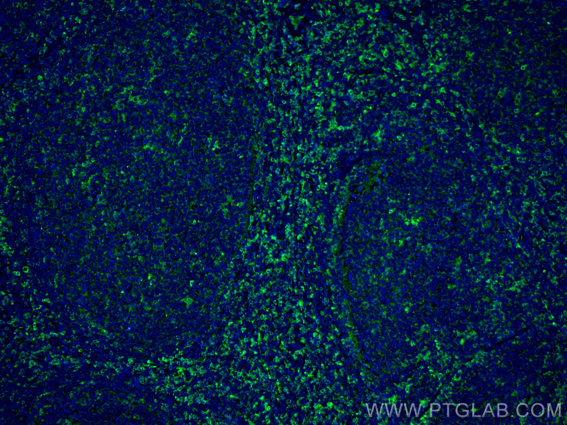 Immunofluorescence (IF) / fluorescent staining of human tonsillitis tissue using CCR6 Monoclonal antibody (66801-1-Ig)
