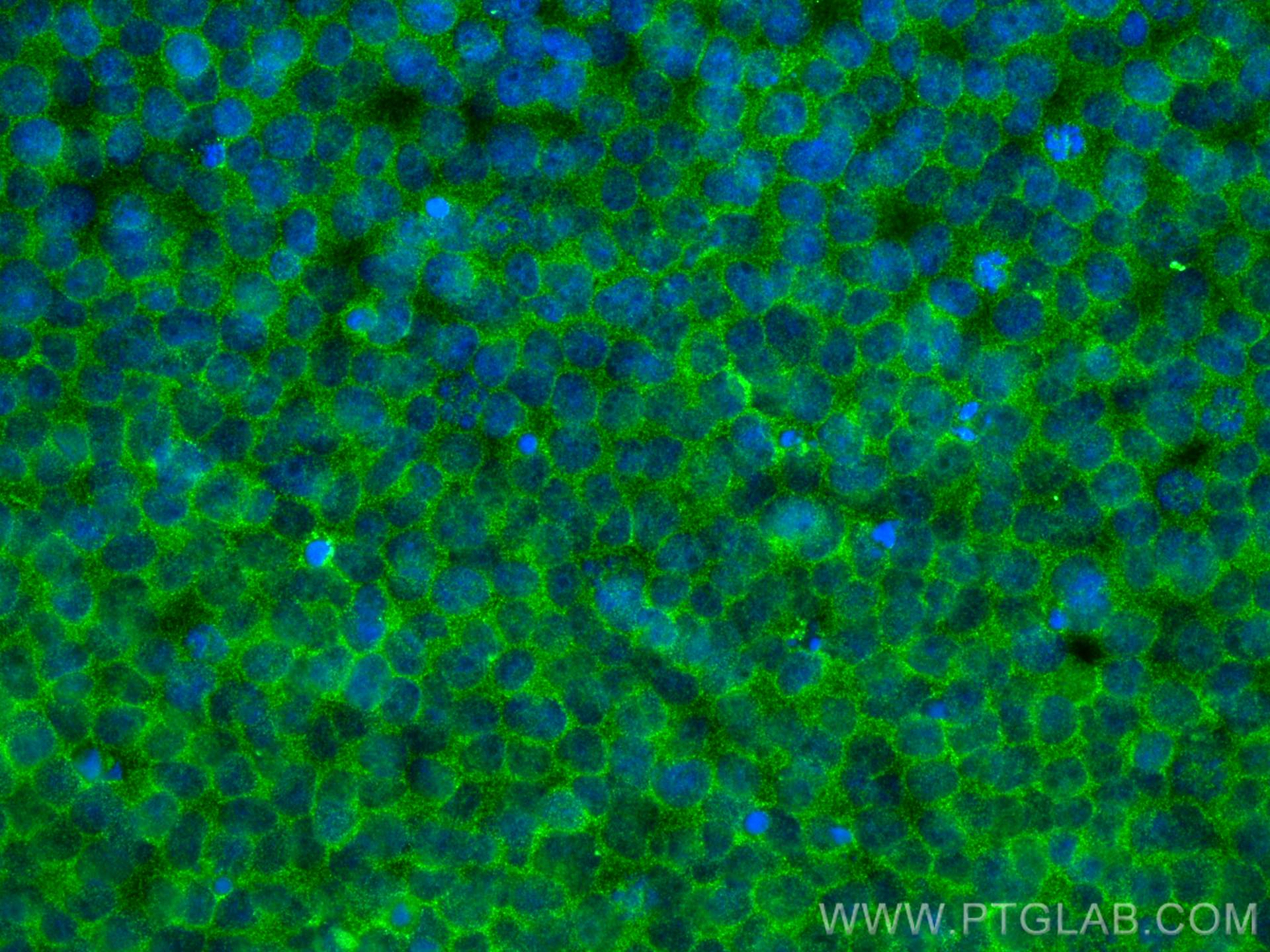Immunofluorescence (IF) / fluorescent staining of Jurkat cells using CCR6 Monoclonal antibody (66801-1-Ig)