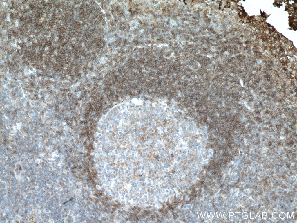 Immunohistochemistry (IHC) staining of human tonsillitis tissue using CCR6 Monoclonal antibody (66801-1-Ig)