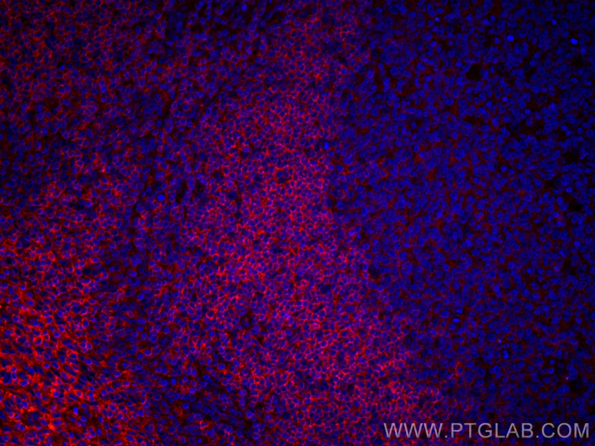 Immunofluorescence (IF) / fluorescent staining of human tonsillitis tissue using CoraLite®594-conjugated CCR6 Monoclonal antibody (CL594-66801)