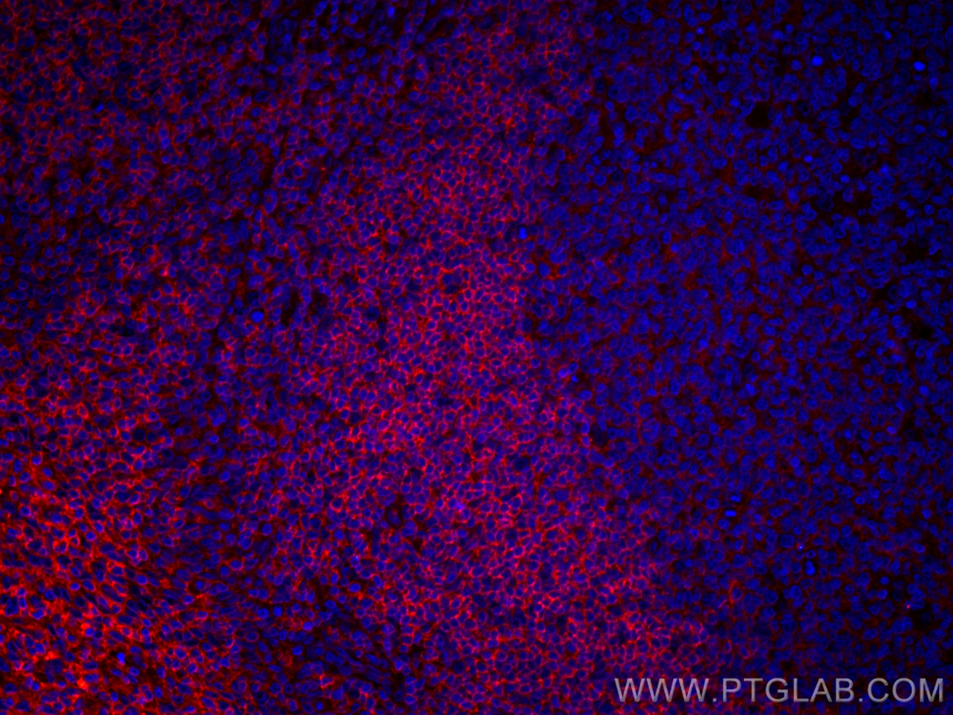 IF Staining of human tonsillitis using CL594-66801