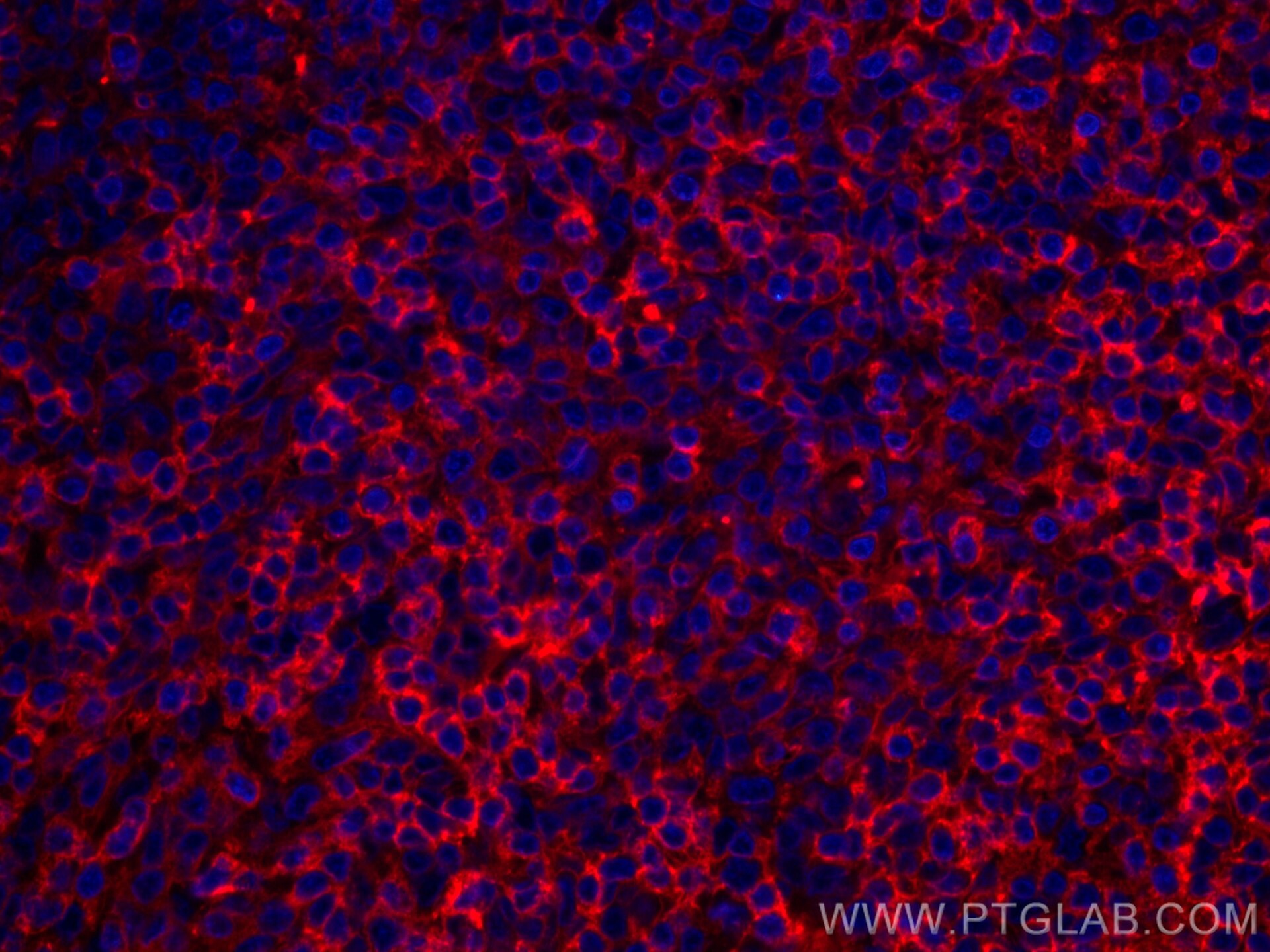 Immunofluorescence (IF) / fluorescent staining of human tonsillitis tissue using CoraLite®594-conjugated CCR6 Monoclonal antibody (CL594-66801)