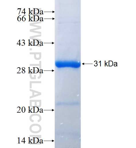 CCR6 fusion protein Ag24185 SDS-PAGE