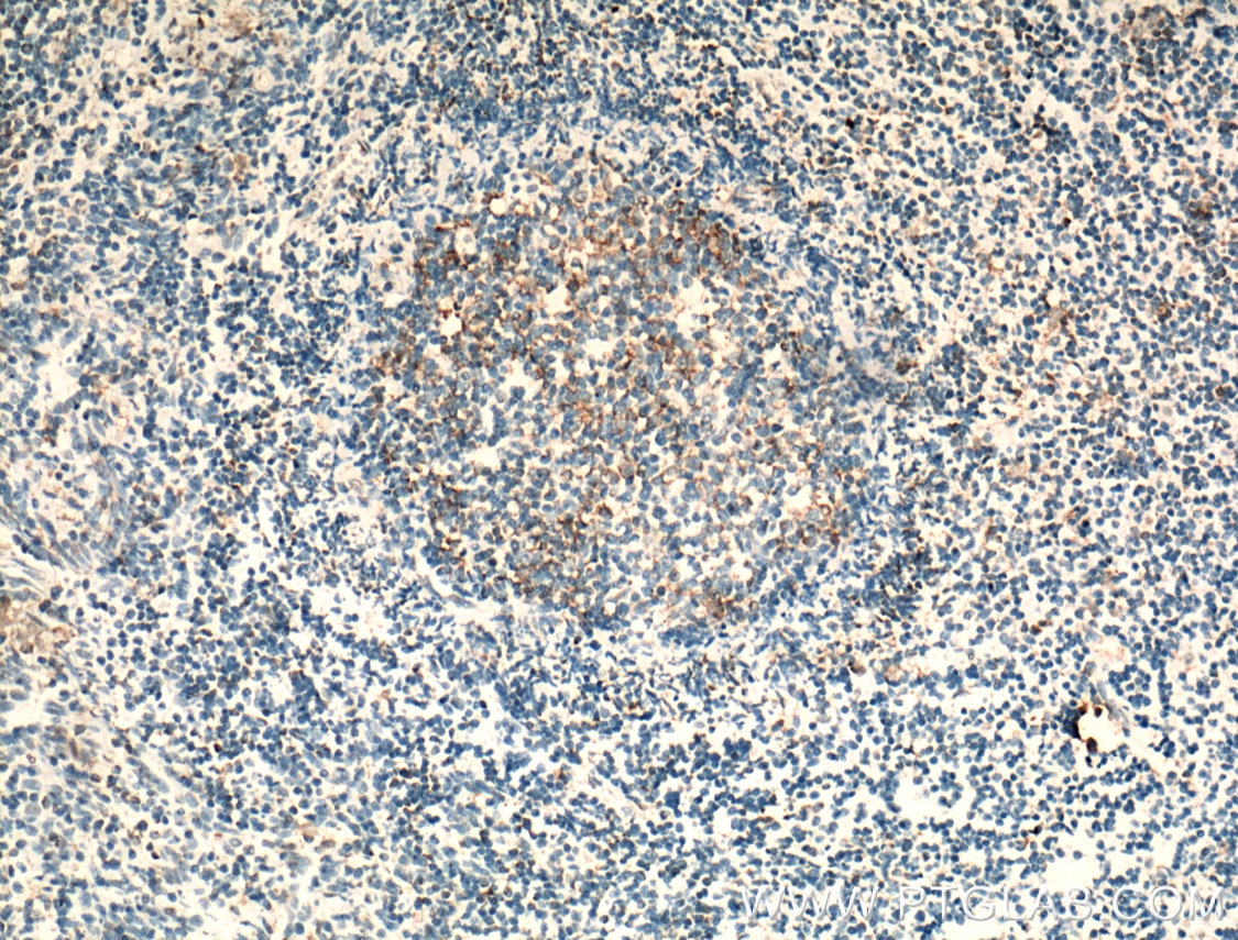 Immunohistochemistry (IHC) staining of human tonsillitis tissue using CCR7 Polyclonal antibody (25898-1-AP)