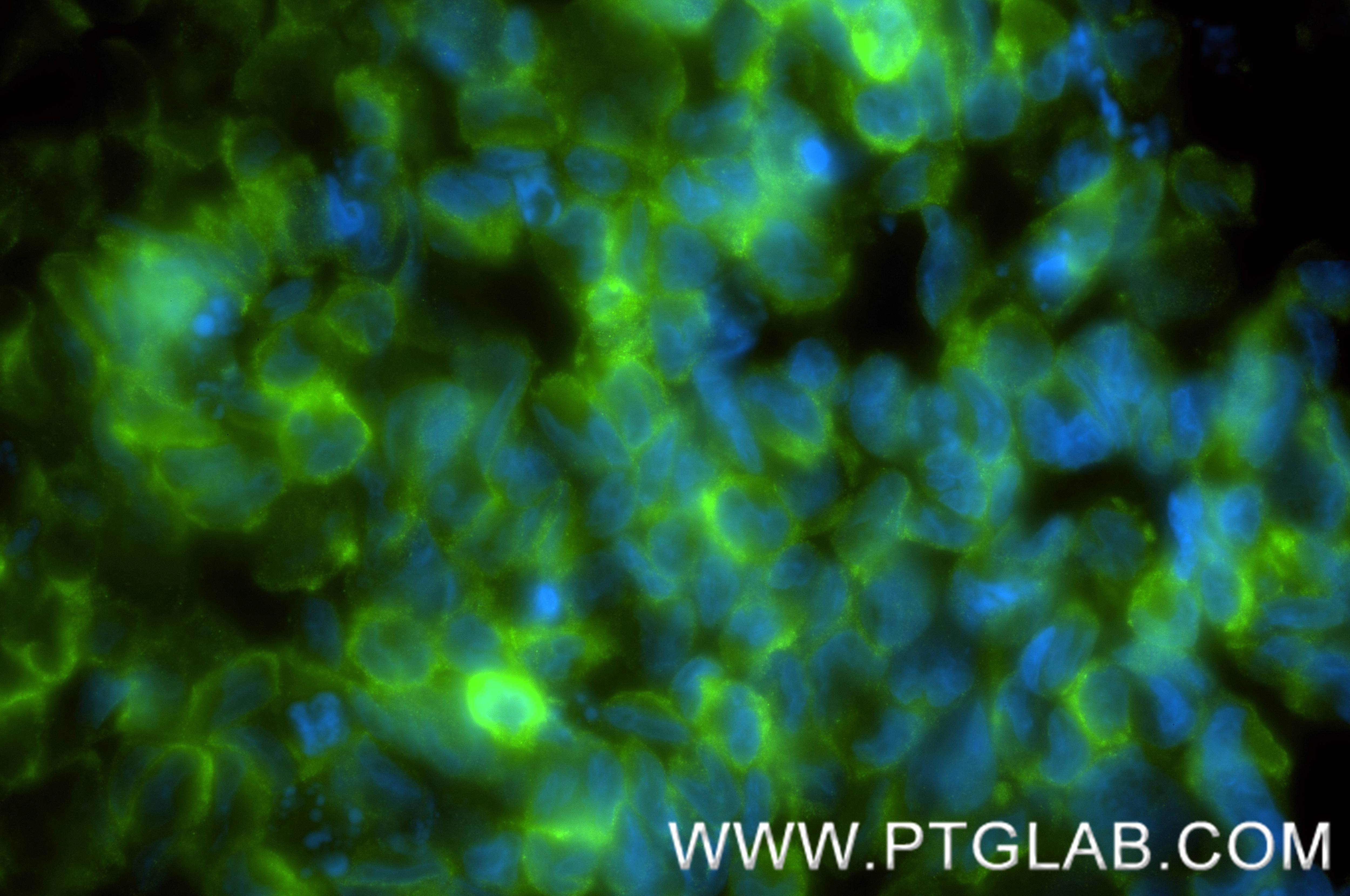 IF Staining of K-562 using 86180-5-RR (same clone as 86180-5-PBS) Immunofluorescence (IF) / fluorescent staining of K-562 cells using CCR7 Recombinant monoclonal antibody (86180-5-RR)