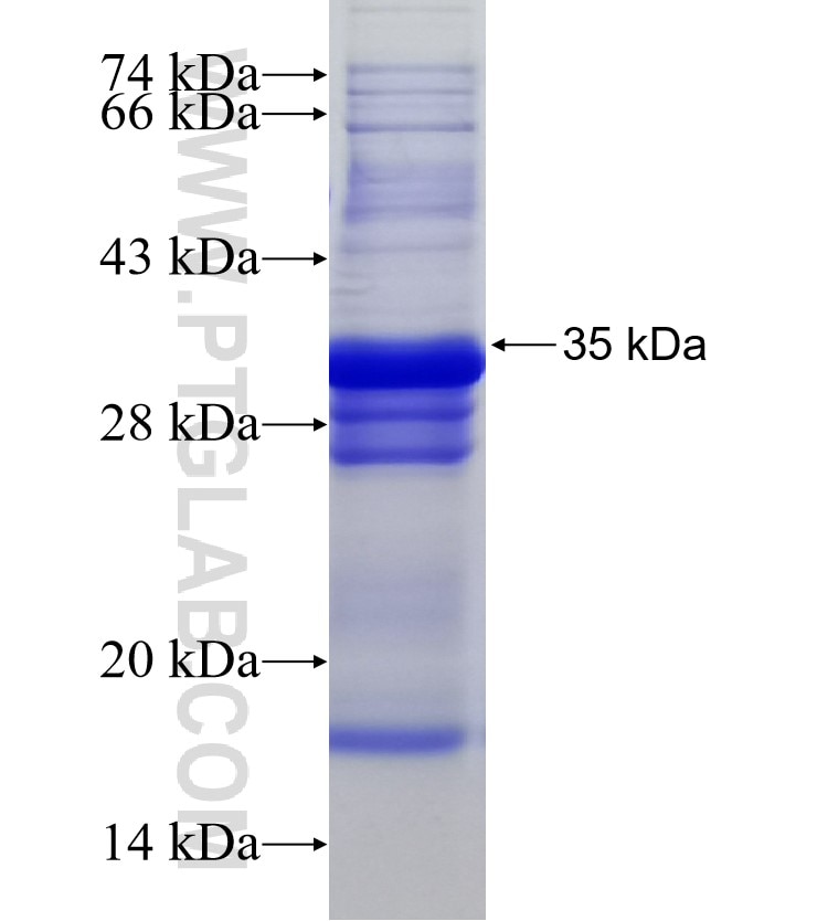 CCR7 fusion protein Ag22941 SDS-PAGE