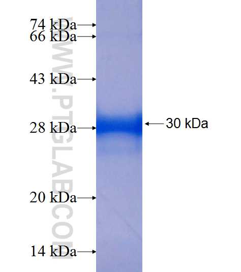 CCRK fusion protein Ag7512 SDS-PAGE