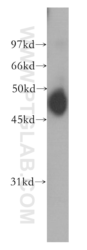 Western Blot (WB) analysis of A431 cells using CCRL2 Polyclonal antibody (13387-1-AP)