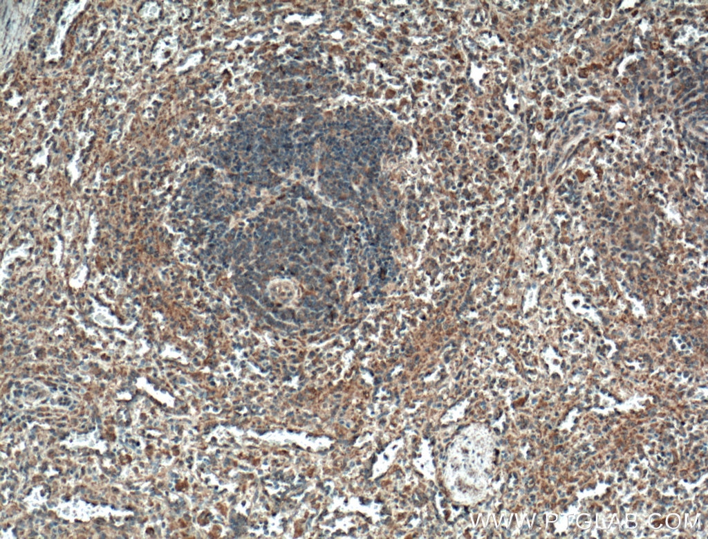 Immunohistochemistry (IHC) staining of human spleen tissue using CCRL2 Monoclonal antibody (66611-1-Ig)