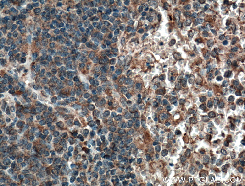 Immunohistochemistry (IHC) staining of human spleen tissue using CCRL2 Monoclonal antibody (66611-1-Ig)