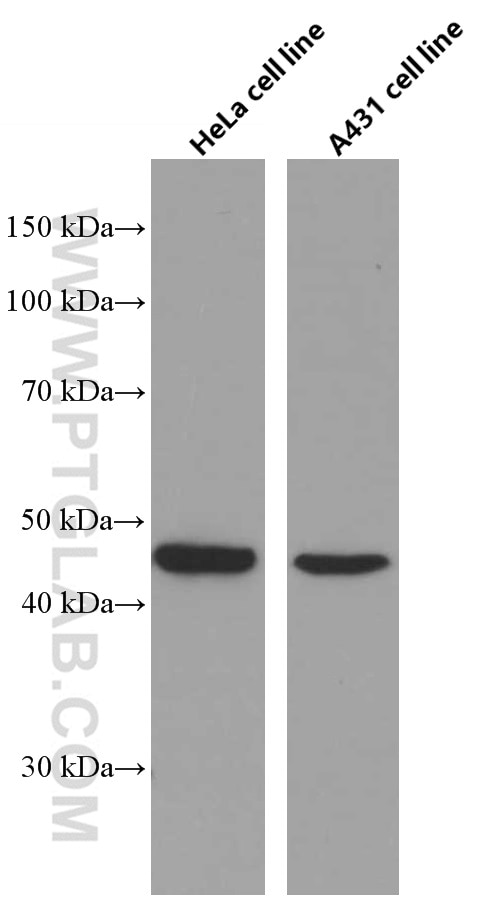 Western Blot (WB) analysis of HeLa cells using CCRL2 Monoclonal antibody (66611-1-Ig)