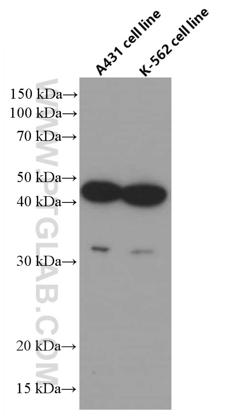 Western Blot (WB) analysis of A431 cells using CCRL2 Monoclonal antibody (66611-1-Ig)