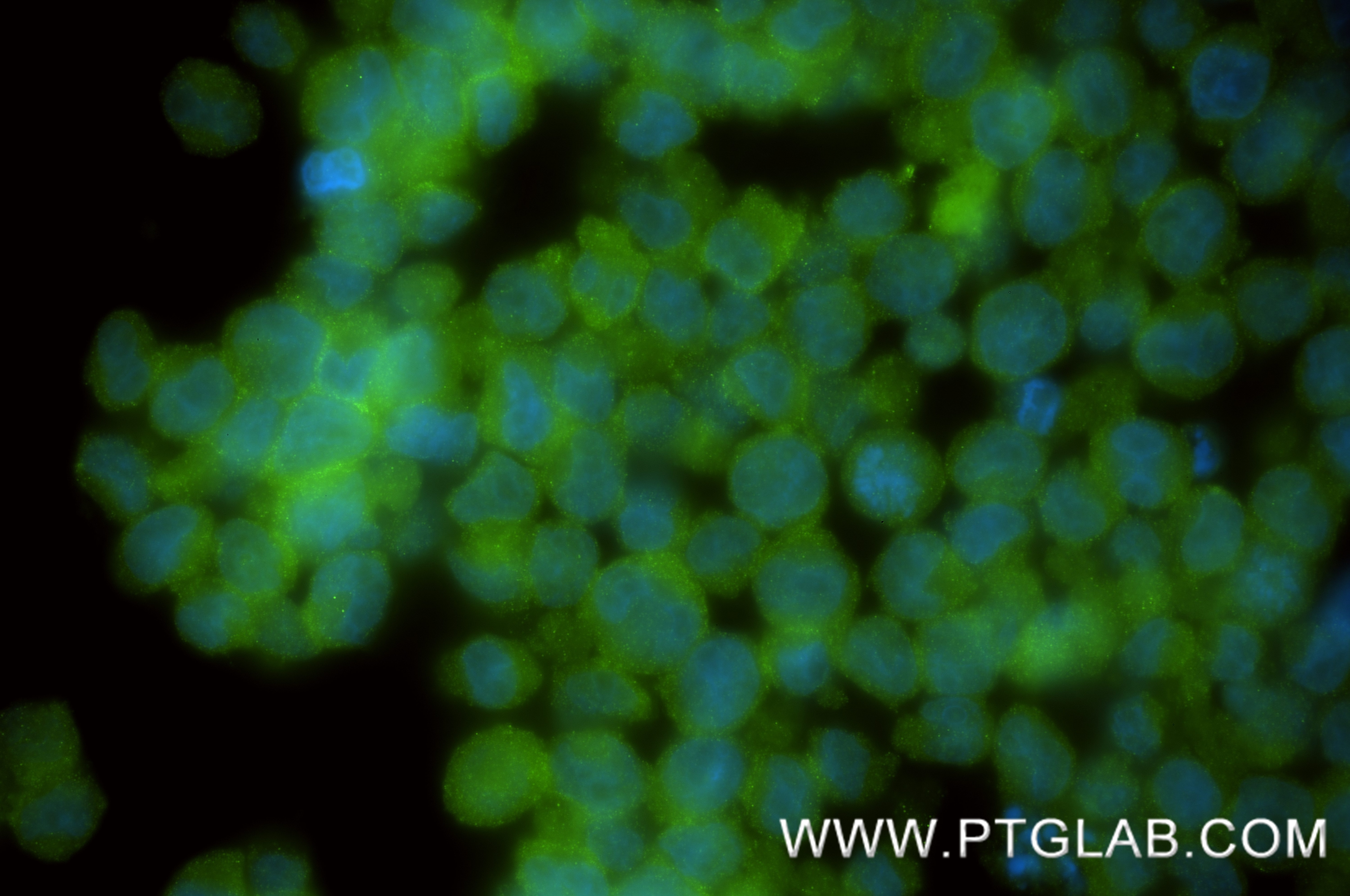 IF Staining of TF-1 using 87505-1-RR Immunofluorescence (IF) / fluorescent staining of TF-1 cells using CCRL2 Recombinant monoclonal antibody (87505-1-RR)