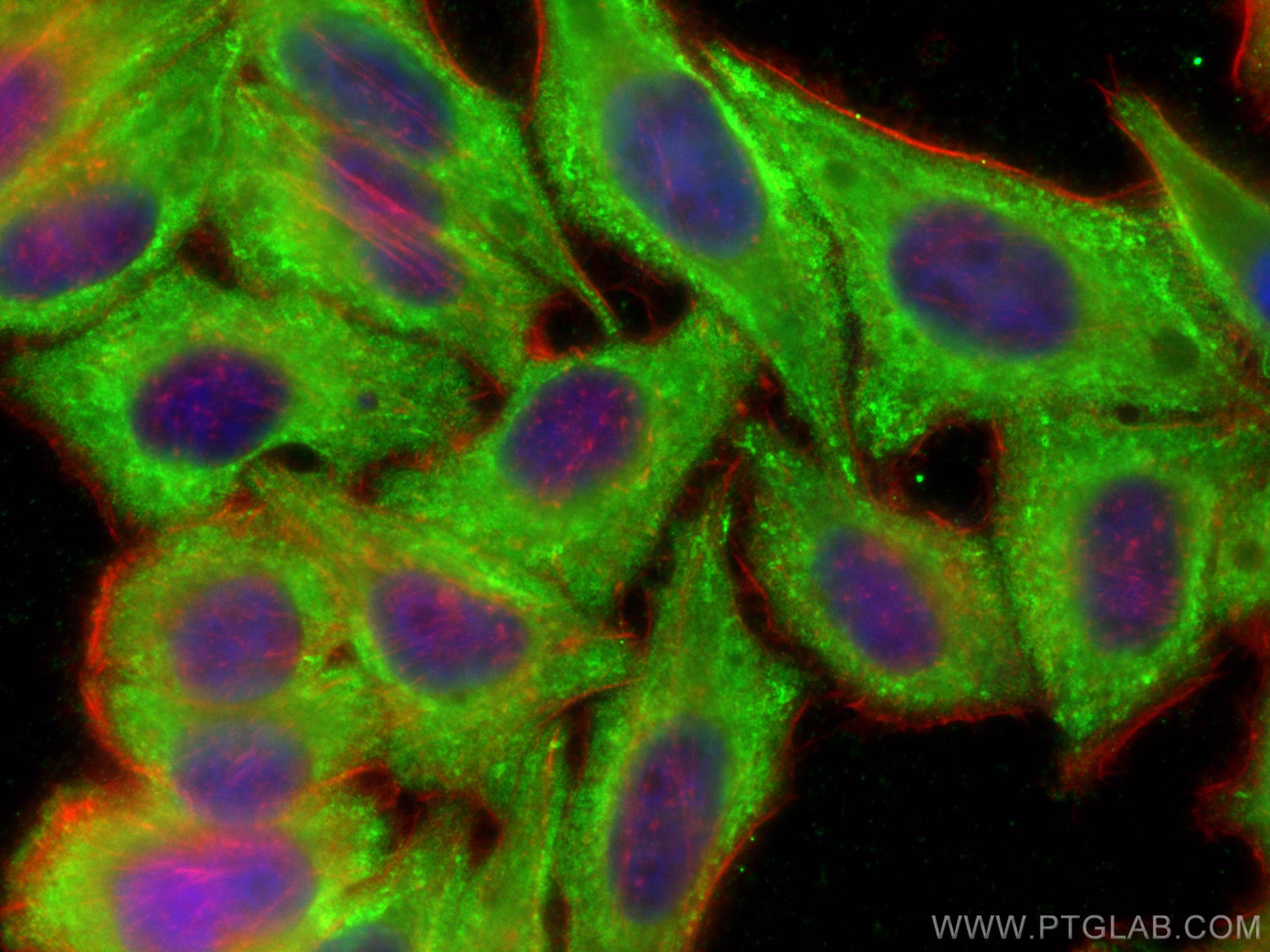 Immunofluorescence (IF) / fluorescent staining of HepG2 cells using CCS Polyclonal antibody (22802-1-AP)