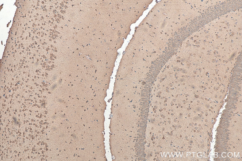 IHC staining of mouse brain using 22802-1-AP