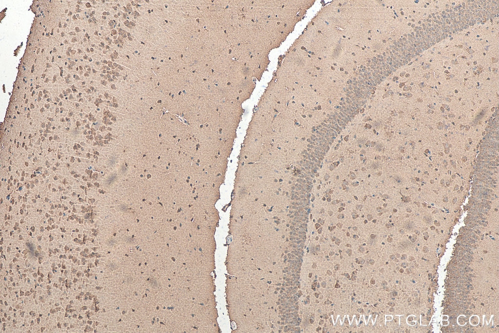 Immunohistochemistry (IHC) staining of mouse brain tissue using CCS Polyclonal antibody (22802-1-AP)