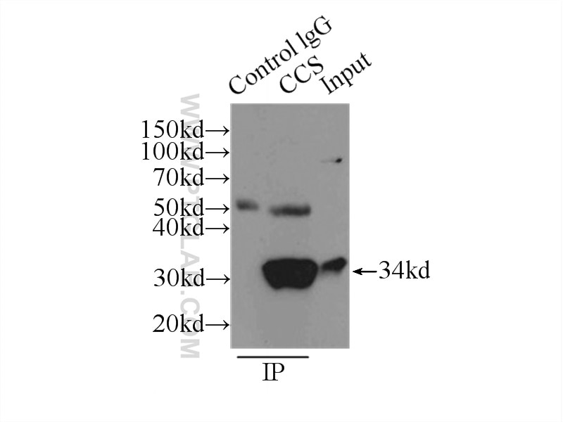 Immunoprecipitation (IP) experiment of HepG2 cells using CCS Polyclonal antibody (22802-1-AP)