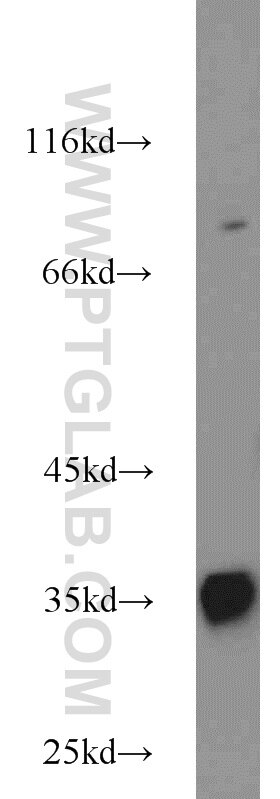 Western Blot (WB) analysis of HepG2 cells using CCS Polyclonal antibody (22802-1-AP)