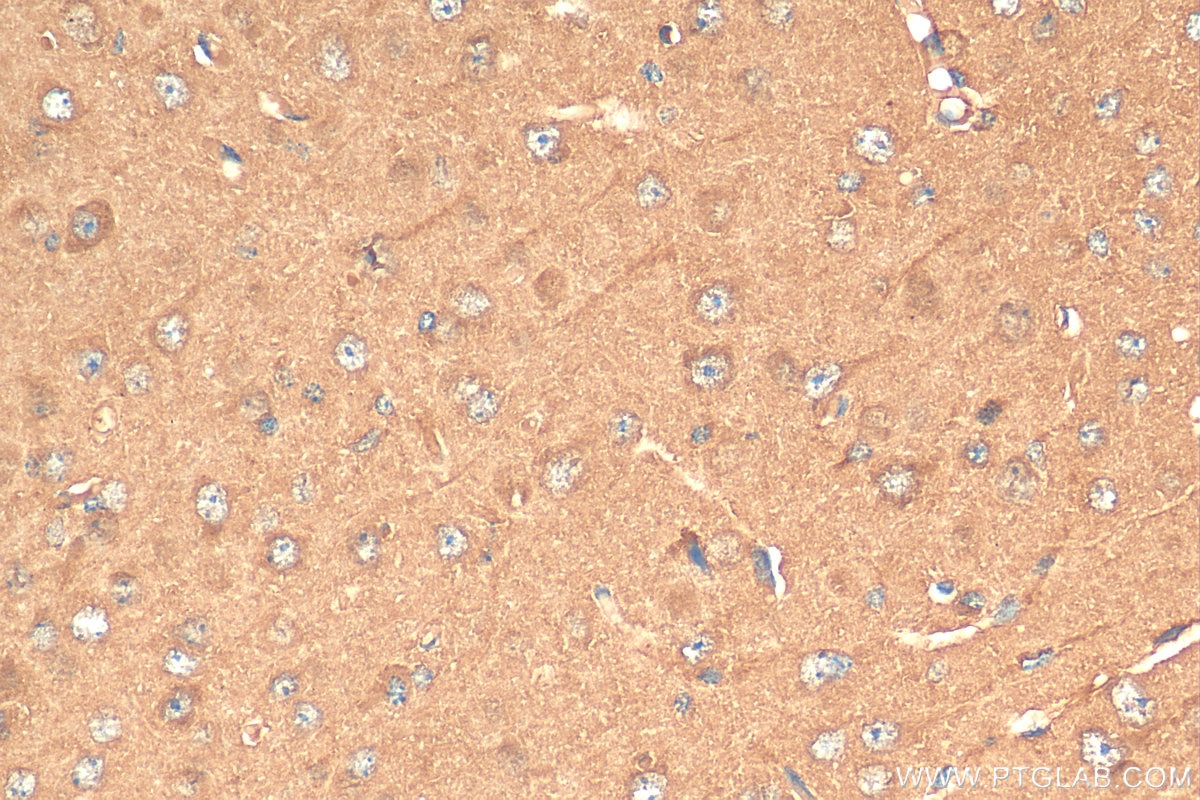 Immunohistochemistry (IHC) staining of mouse brain tissue using CCS Monoclonal antibody (68341-1-Ig)