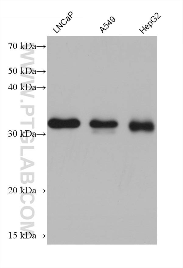 Western Blot (WB) analysis of various lysates using CCS Monoclonal antibody (68341-1-Ig)