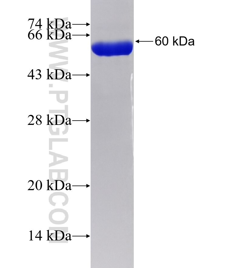 CCS fusion protein Ag18850 SDS-PAGE