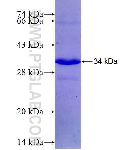 CCS fusion protein Ag18860 SDS-PAGE