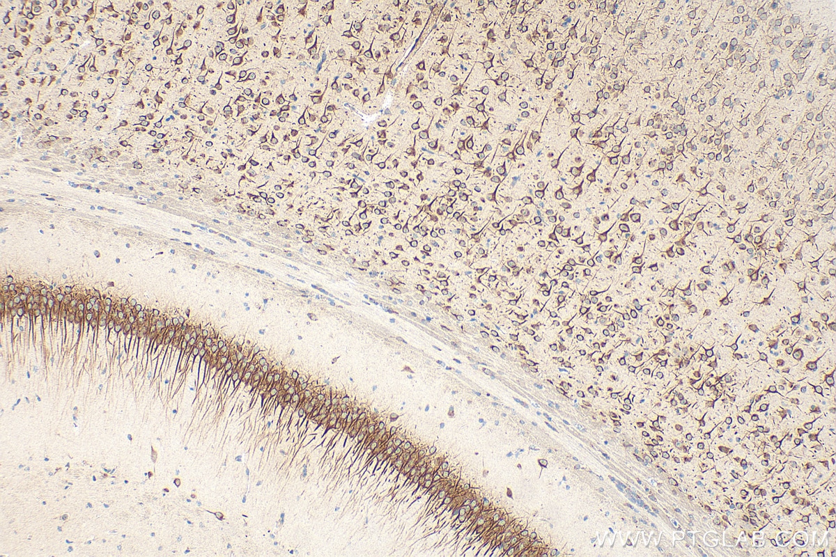 Immunohistochemical analysis of paraffin-embedded mouse brain tissue slide using 28644-1-AP (CCSAP antibody) at dilution of 1:200 (under 10x lens). Heat mediated antigen retrieval with Tris-EDTA buffer (pH 9.0). Immunohistochemistry (IHC) staining of mouse brain tissue using CCSAP Polyclonal antibody (28644-1-AP)