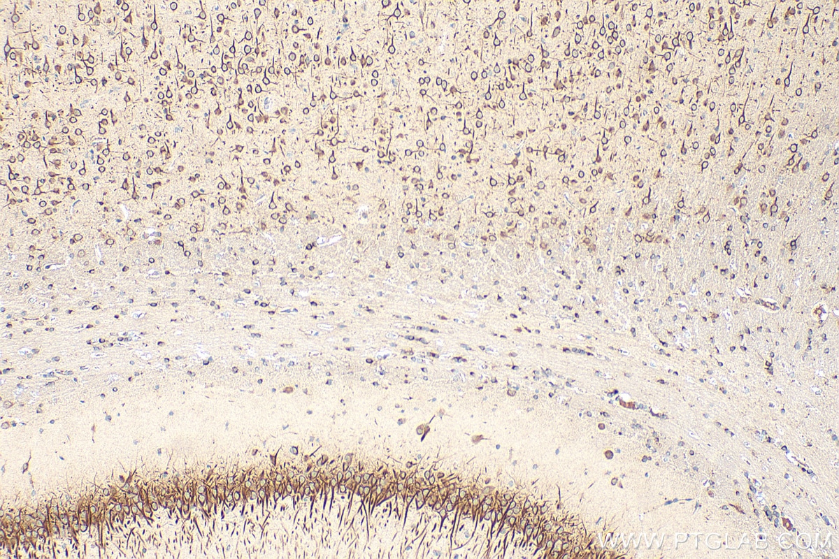 Immunohistochemical analysis of paraffin-embedded rat brain tissue slide using 28644-1-AP (CCSAP antibody) at dilution of 1:200 (under 10x lens). Heat mediated antigen retrieval with Tris-EDTA buffer (pH 9.0). Immunohistochemistry (IHC) staining of rat brain tissue using CCSAP Polyclonal antibody (28644-1-AP)