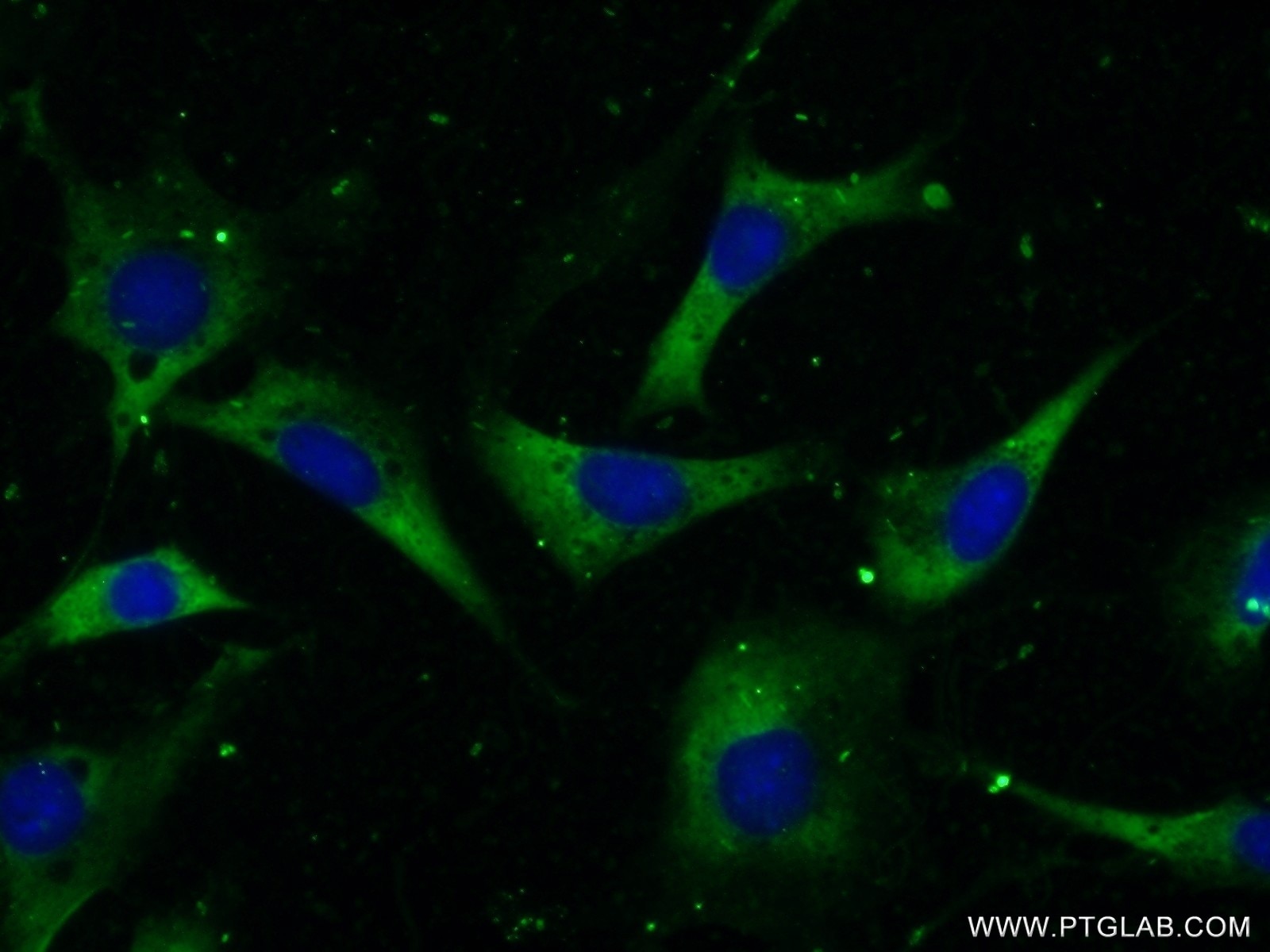 Immunofluorescence (IF) / fluorescent staining of NIH/3T3 cells using CCT2 Polyclonal antibody (24896-1-AP)