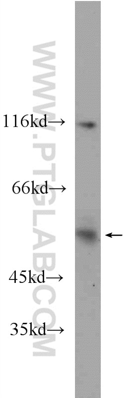 Western Blot (WB) analysis of NIH/3T3 cells using CCT2 Polyclonal antibody (24896-1-AP)