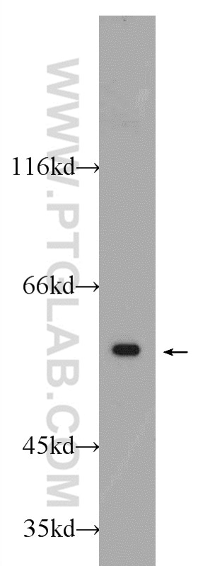 Western Blot (WB) analysis of Jurkat cells using CCT2 Polyclonal antibody (24896-1-AP)